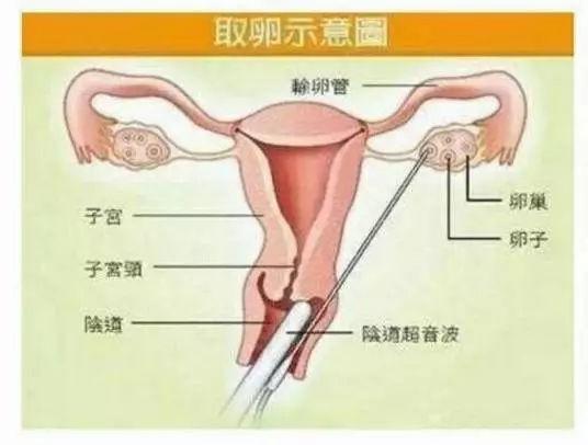 电子产品 第48页