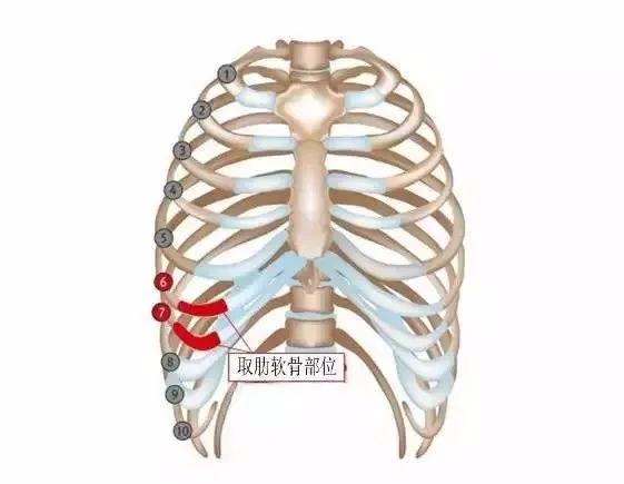 试管取卵后肋骨两边痛，原因、应对与康复之路